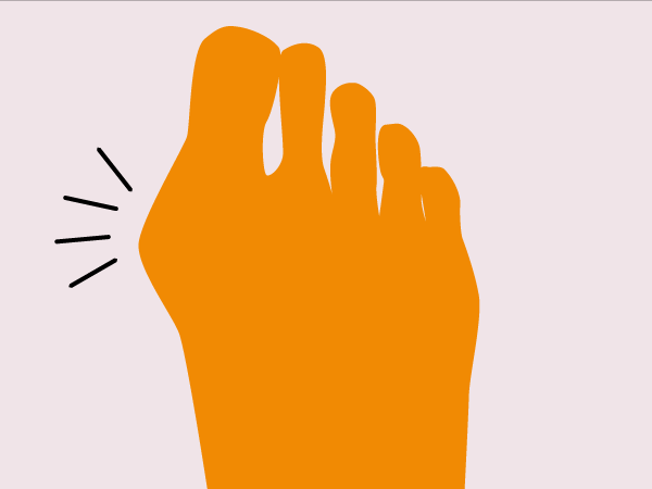 Wat gebeurt er bij een verkeerde breedtemaat?